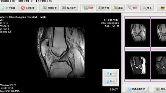 dicom图像浏览器(Philips DICOM Viewer)