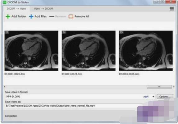 DICOM to Video(DICOM转视频工具)